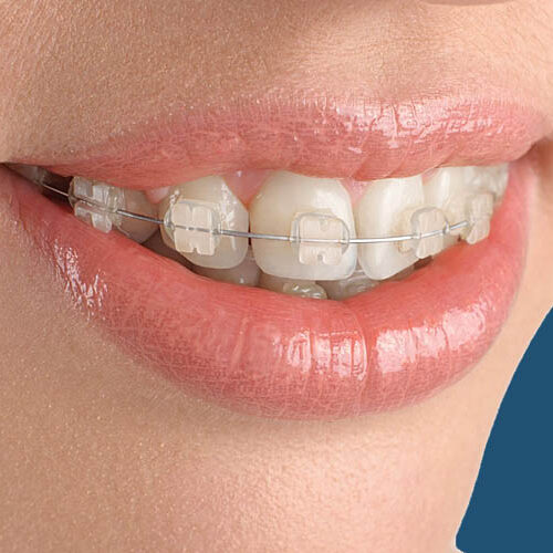 Explore a full spectrum of dental treatments at CIMA Oral Surgery Clinic in Tijuana. From routine care to advanced procedures, all in one convenient location.